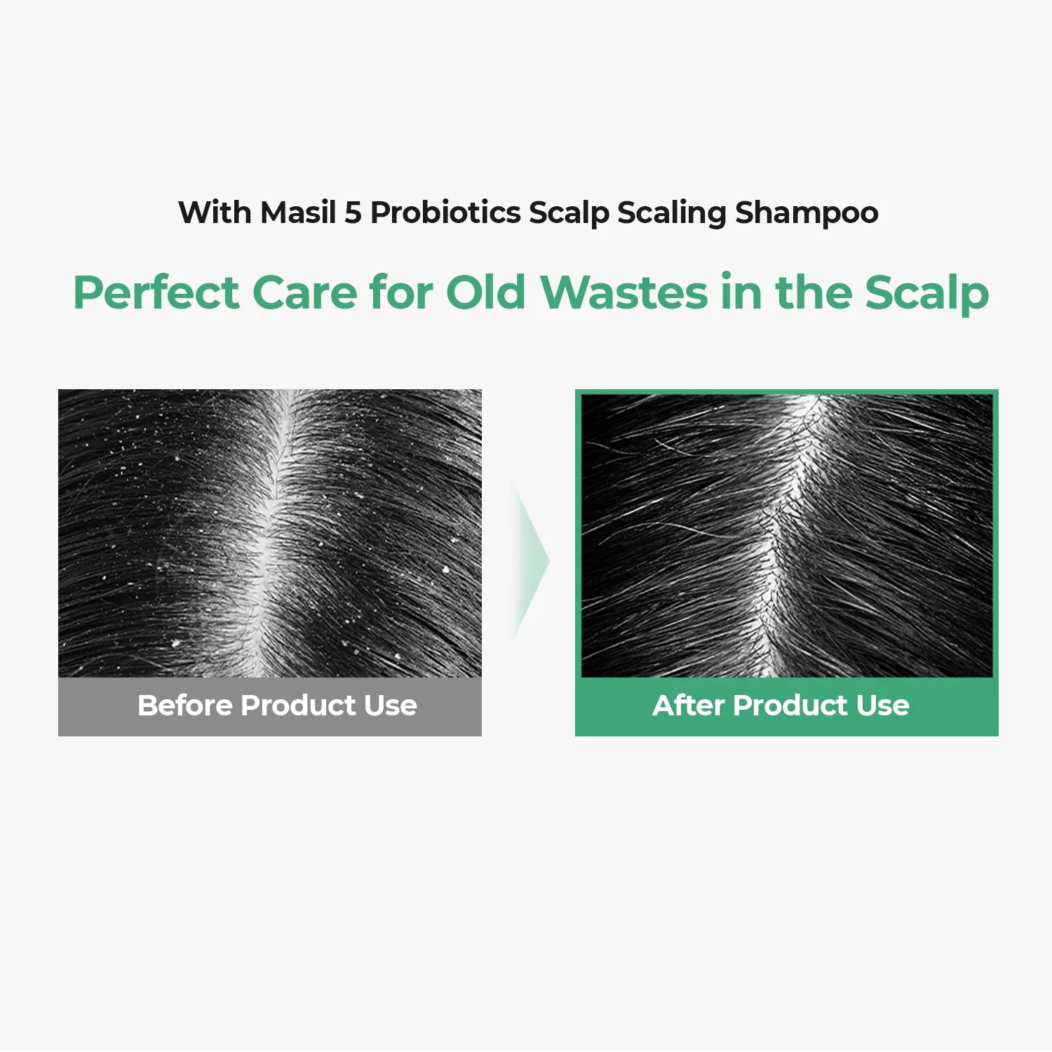 MASIL - 5 Probiotics Scalp Scaling Shampoo 300ml