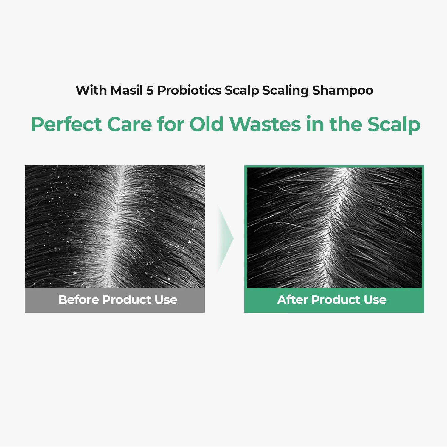 MASIL 5 Probiotics Scalp Scaling Shampoo 300ml